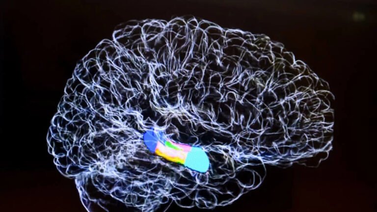 Poor Metabolic Health Linked to Reduced Brain Blood Flow - AOL