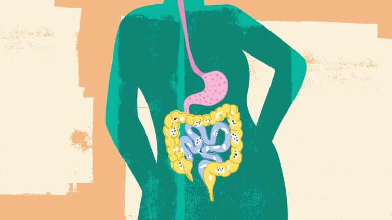 Should I take a probiotic? And other gut questions, answered : Life Kit: Health