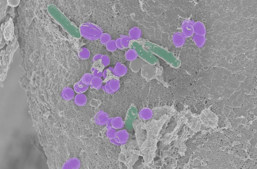 A few purple rods and green spheres against a grey background.