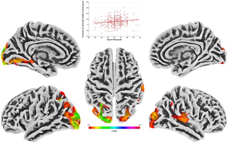 Study finds estrogen-based hormone therapies could protect brain health in older women Study finds estrogen-based hormone therapies could protect brain health in older women