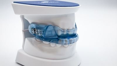 SSM Device Photos-3 (1).jpg