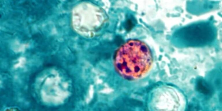Case of cyclosporiasis confirmed in Hawaii visitor Case of cyclosporiasis confirmed in Hawaii visitor