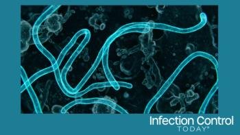 Microscopic view of Ebola virus particles  (Adobe Stock 2032931568 by MdLutfor)