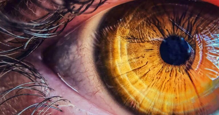 Daylight saving could affect your risk of developing eye disease Daylight saving could affect your risk of developing eye disease