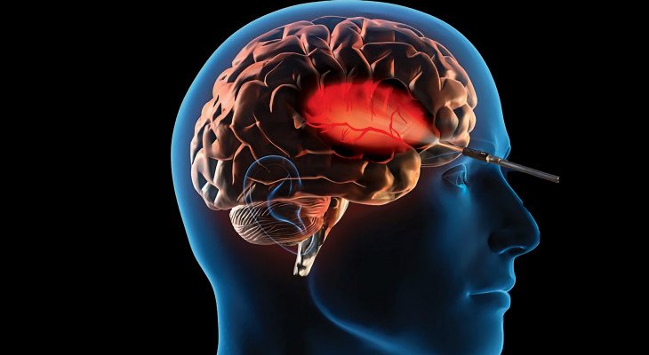 How Quality Sleep Helps Safeguard Your Brain Health – BW Healthcare World How Quality Sleep Helps Safeguard Your Brain Health - BW Healthcare World