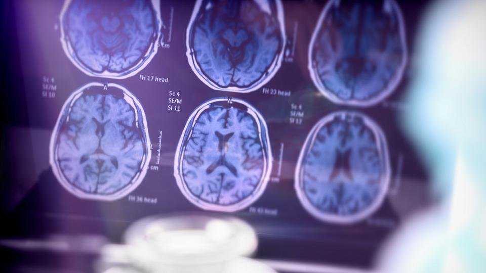 Image of a brain scan