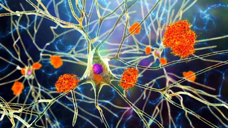 KY scientists learned what causes sleep loss in Alzheimer’s patients — and how to stop it  • Kentucky Lantern