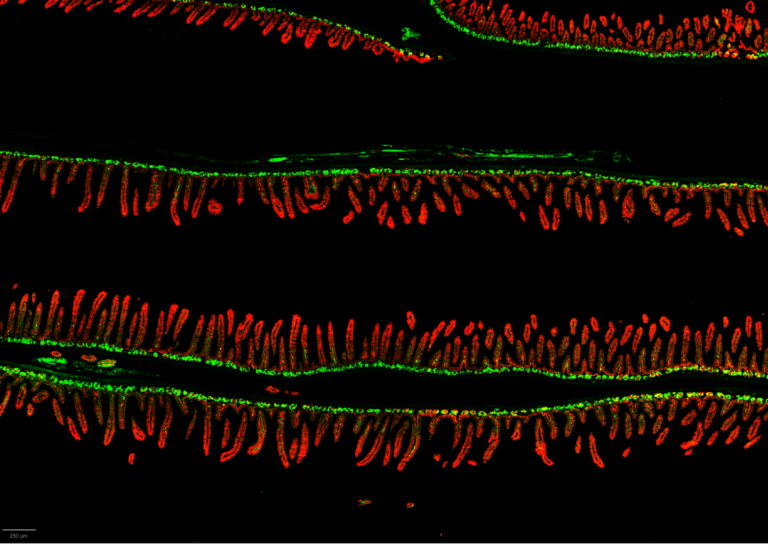 Gut bacteria linked to malnutrition may pass to younger generations | WashU Medicine Gut bacteria linked to malnutrition may pass to younger generations | WashU Medicine