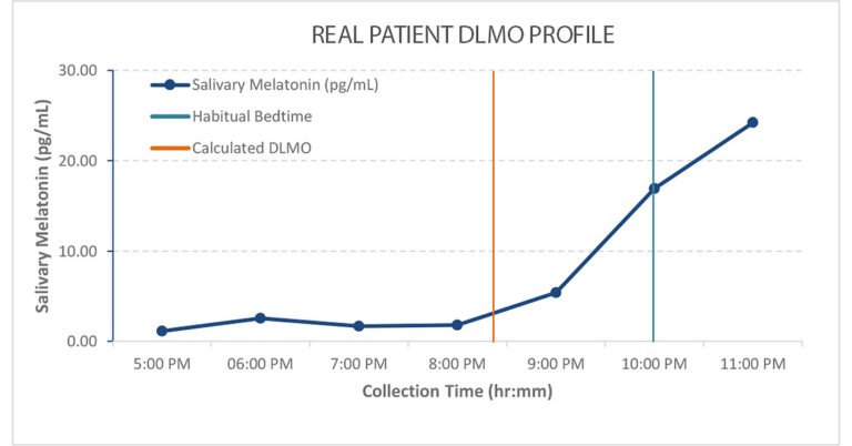 New Study in Sleep Medicine Introduces a Clinical Framework for Interpreting Home-Based DLMO Assessments
