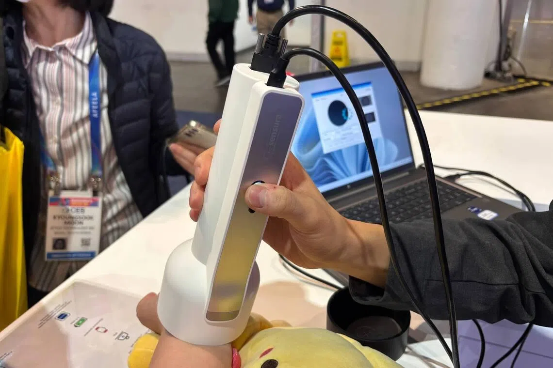 Sensura is in talks with several hospitals in Singapore to trial the handheld device, which can also detect blood glucose levels.