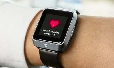 Wearable technology reveals hidden heart rhythm disorders and stroke risk Wearable technology reveals hidden heart rhythm disorders and stroke risk