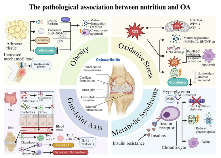 Frontiers | Nutritional interventions for osteoarthritis: targeting the metabolism-inflammation-oxidative stress axis—clinical evidence and translational practice Frontiers | Nutritional interventions for osteoarthritis: targeting the metabolism-inflammation-oxidative stress axis—clinical evidence and translational practice