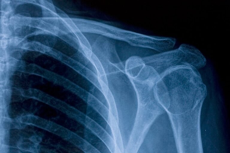 How sleep and your body clock help keep your bones strong How sleep and your body clock help keep your bones strong