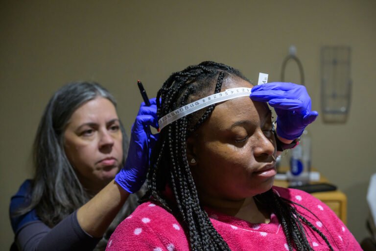 Gloved hands of a technologist measuring a patient's head with a tape measure.