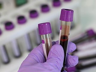 The licences of four blood banks have been revoked by Egypt's Ministry of Health over serious violations posing risk to patients.