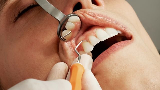 Gum Disease May Accelerate Bone Loss Through the Gut Microbiome Gum Disease May Accelerate Bone Loss Through the Gut Microbiome