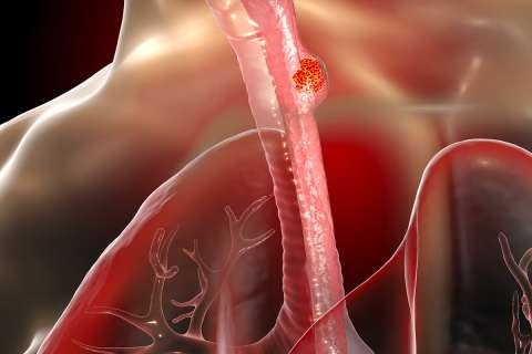 Esophagus illustration
