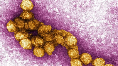 Belgium reports its first two deaths from the West Nile virus.
