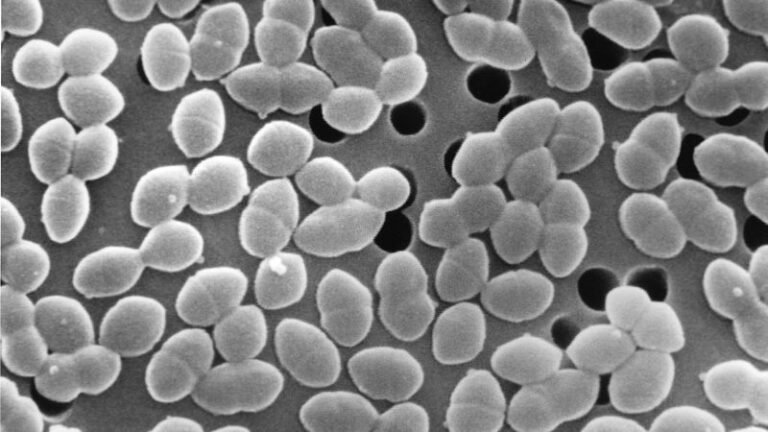 Eating sugar while taking antibiotics might harm gut bacteria | CNN Eating sugar while taking antibiotics might harm gut bacteria | CNN