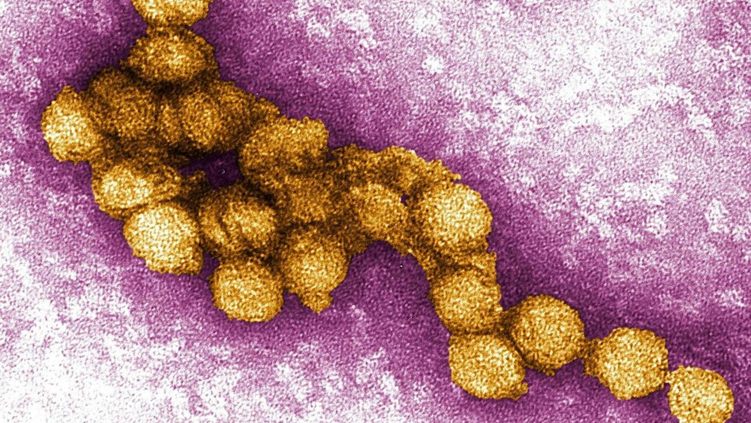 West_Nile_Virus_Image.jpg