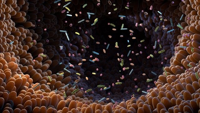 Clinical Trial Asks Whether Gut Health Influences Ovarian Cancer Treatment Outcomes Clinical Trial Asks Whether Gut Health Influences Ovarian Cancer Treatment Outcomes